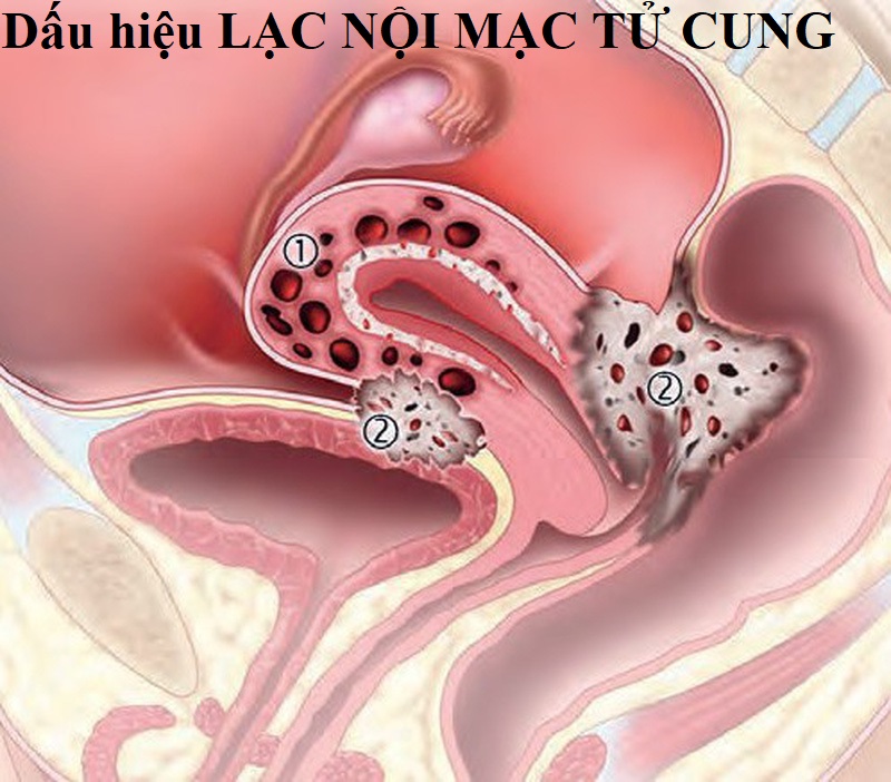 dau-rat-am-ho-khi-den-ngay-hanh-kinh