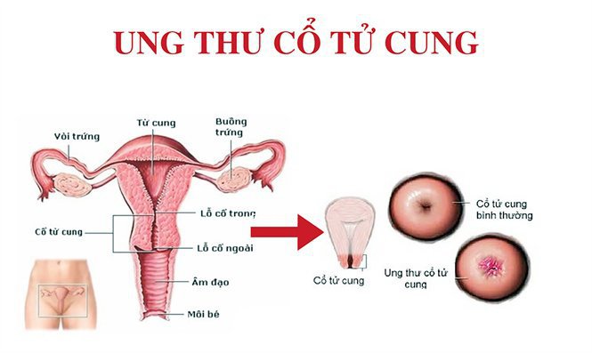 vua-het-kinh-15-ngay-lai-co-kinh-tiep-nguyen-nhan-do-dau