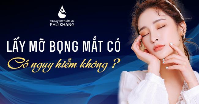 Lấy mỡ bọng mắt có nguy hiểm không