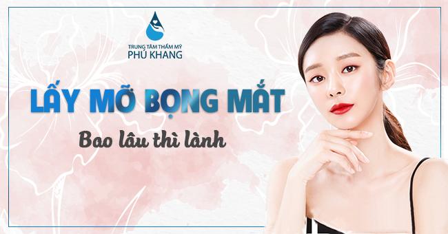 Lấy mỡ bọng mắt bao lâu thì lành