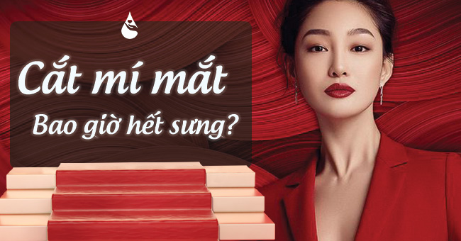 cắt mí bao lâu hết sưng