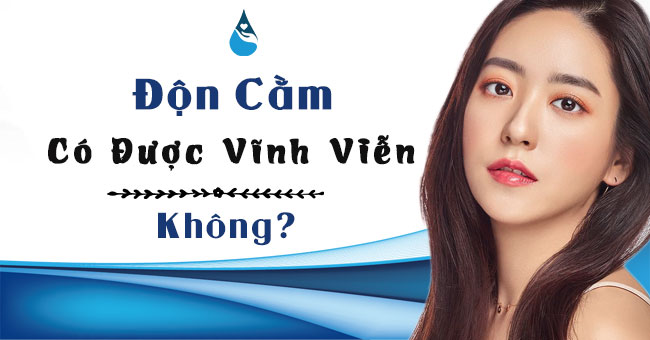 độn cằm có được vĩnh viễn không