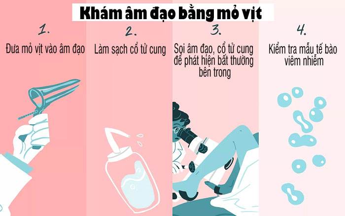 Quy trình khám âm đạo bằng mỏ vịt