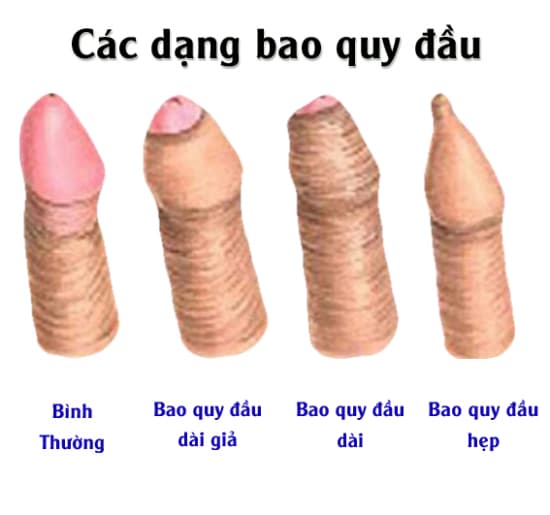 Bao quy đầu là gì?