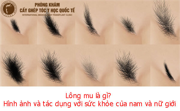 Tướng phụ nữ lông mu rậm thể hiện điều gì? | Blog