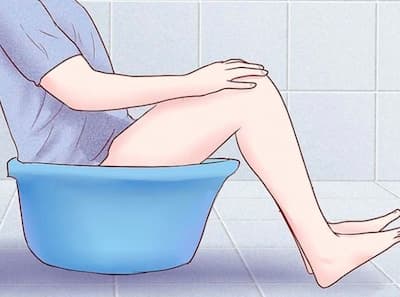 Điều trị bệnh trĩ bằng nước ấm