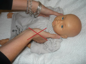 How not to lift an infant