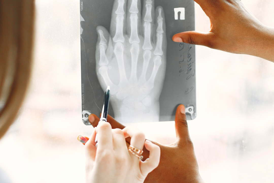 Hand Therapy Attributes of a Good Practitioner The Hands Physio