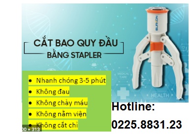 Cắt bao quy đầu bằng máy stapler ở Hải Phòng