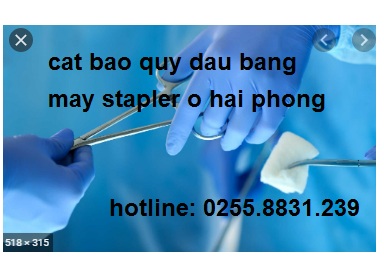 Cắt bao quy đầu bằng máy stapler ở Hải Phòng