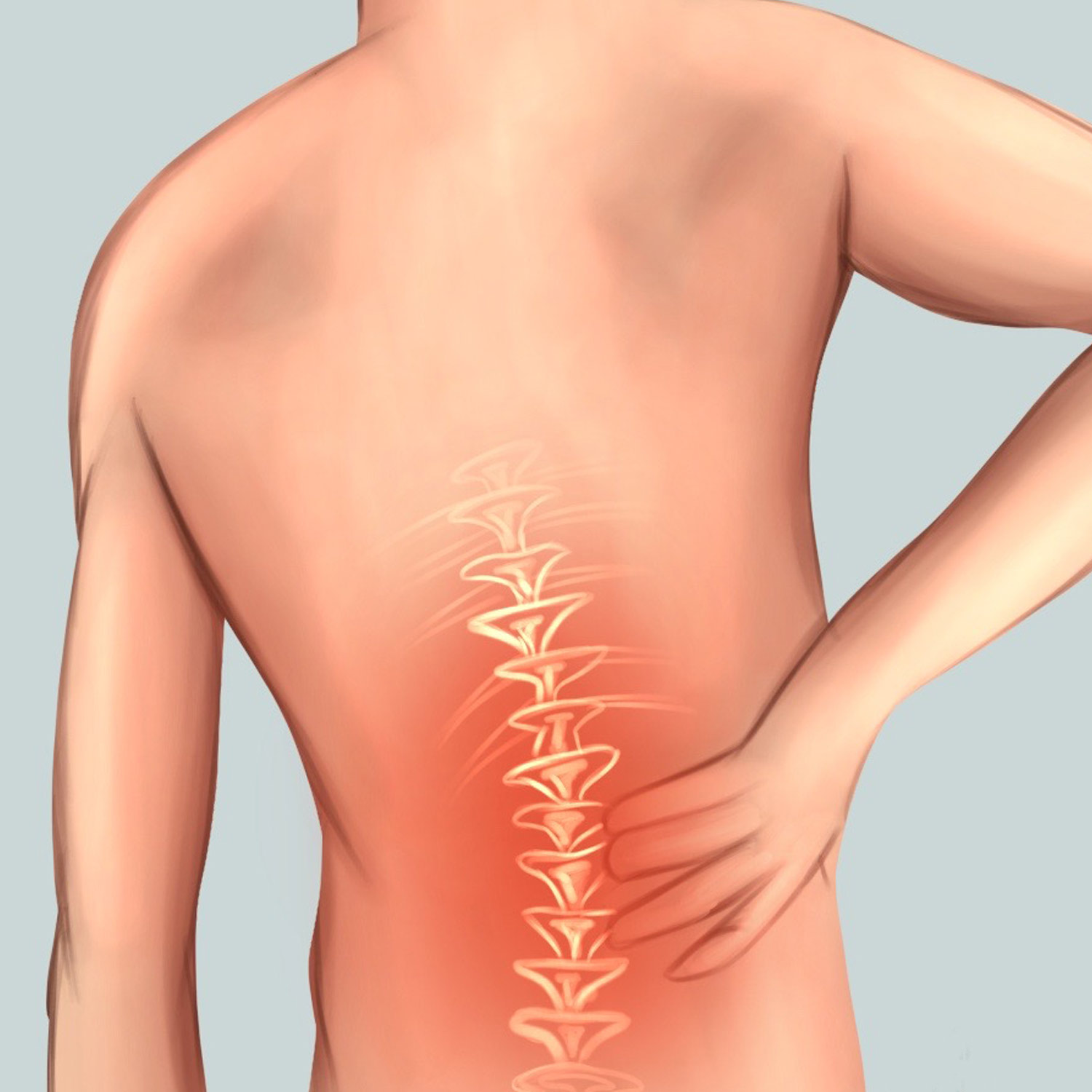 Back Pain Illustration