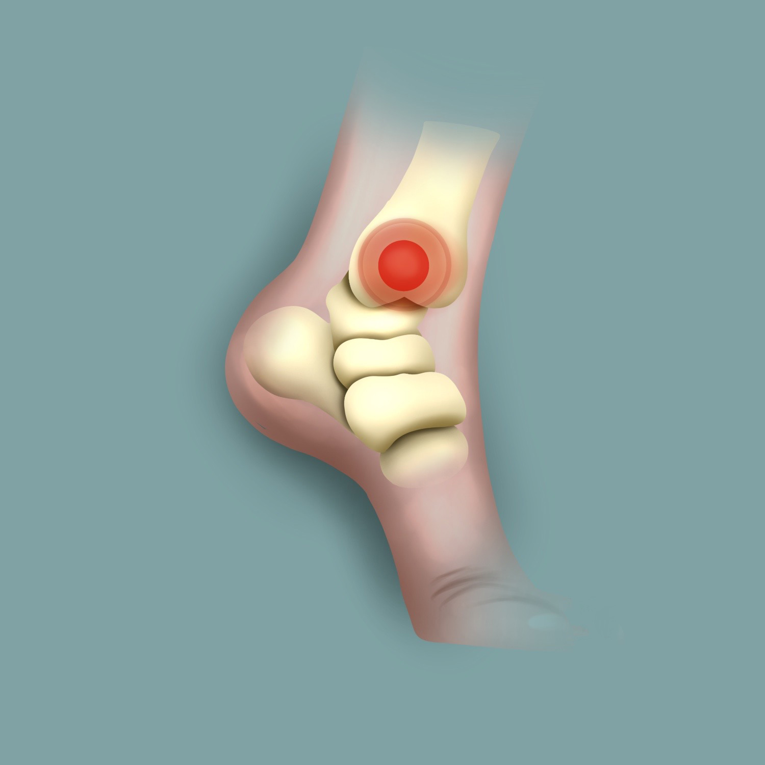 Foot/ankle pain