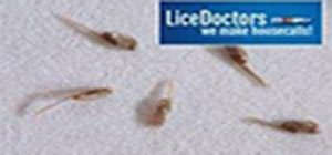 what do does lice eggs nits look like