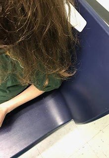 lice tips severe infestation untreated effective treatment nit bug egg free