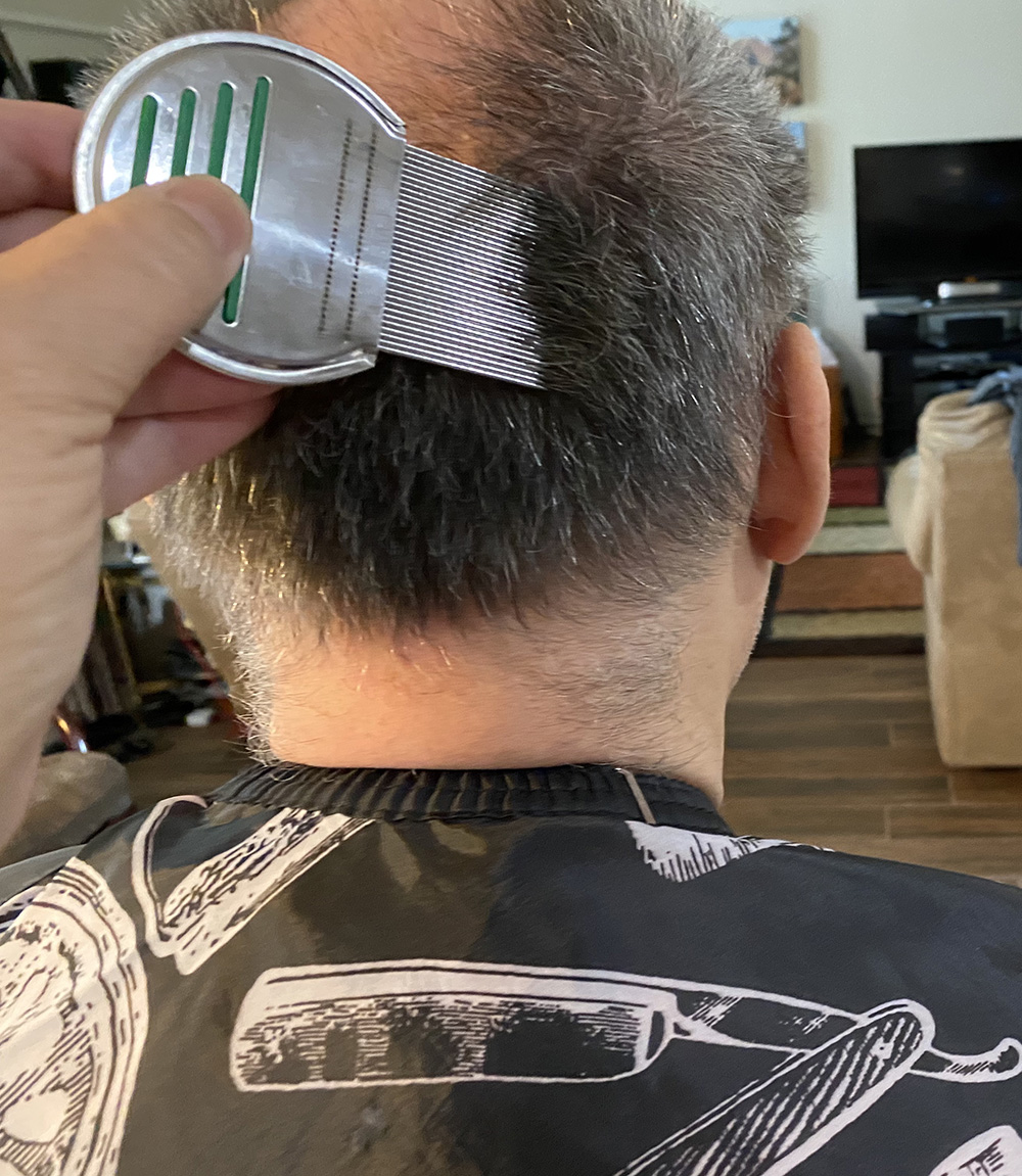 Lice Treatment in Denton, TX
