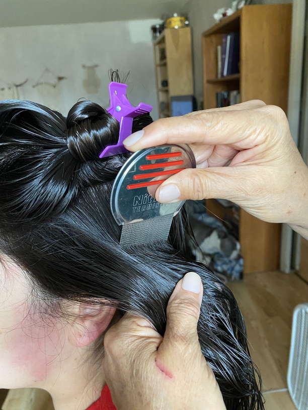 Lice Treatment in Fontana, CA