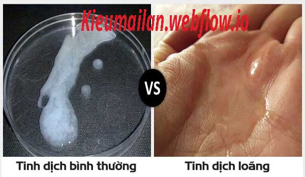 Tinh trùng là gì? Đôi điều về tinh trùng ai cũng nên biết