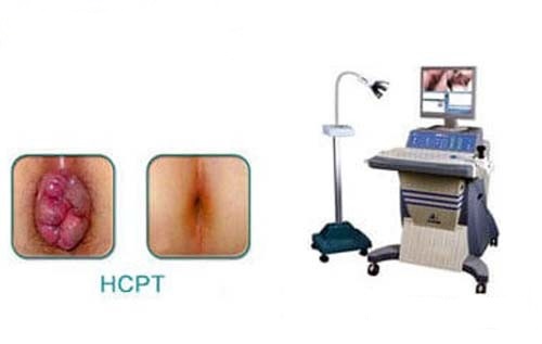 TÌM HIỂU VỀ KỸ THUẬT XÂM LẤN TỐI THIỂU HCPT