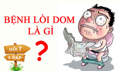 Những thông tin cần thiết của bệnh lòi dom