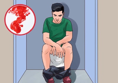 Đại tiện ra máu