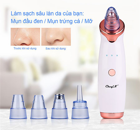 máy hút mụn tốt nhất hiện nay