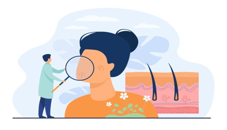 phân biệt da nhạy cảm và da dị ứng