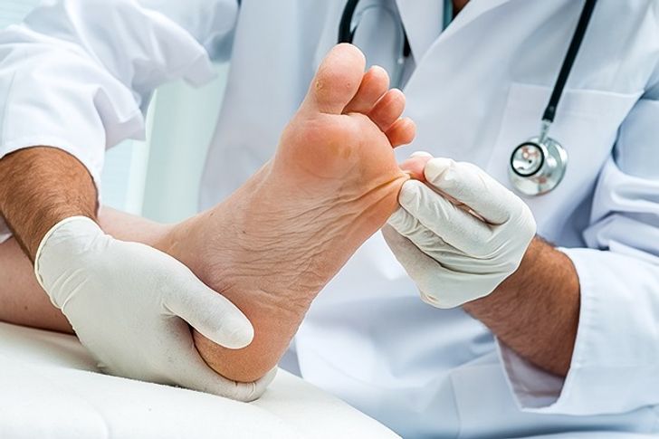 Cách hay để loại bỏ mùi hôi chân vào mùa hè nóng bức - 8