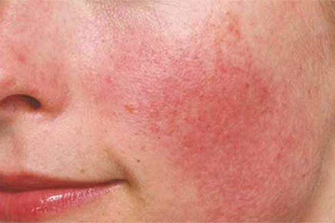 Giải pháp chống lão hóa mới từ Nhật Bản thay thế các chất nhạy cảm - 2