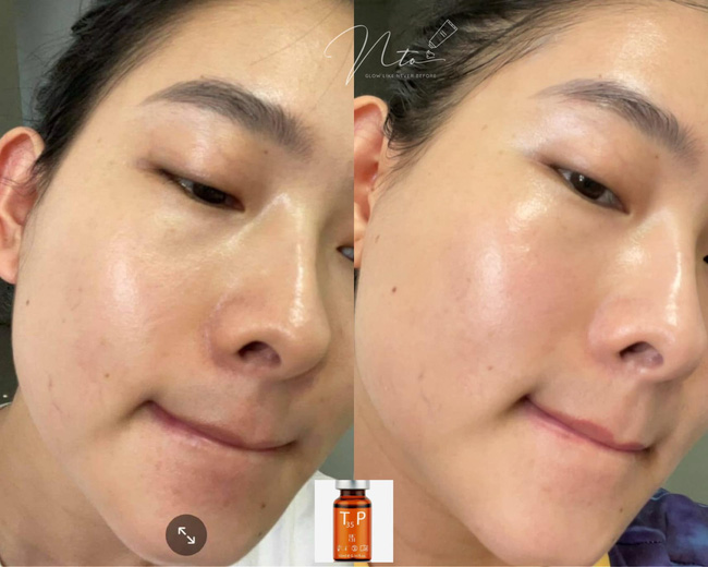Tự peel da tại nhà, cô nàng này bị ngứa râm ran nhưng kết quả nhận được là làn da căng bóng mỹ mãn - Ảnh 5.