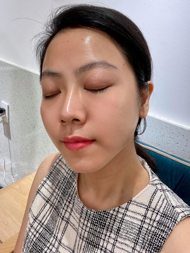 Cô nàng chia sẻ bí kíp thần sầu khi dùng Tretinoin: Muốn da căng bóng thì không được lười - Ảnh 8.