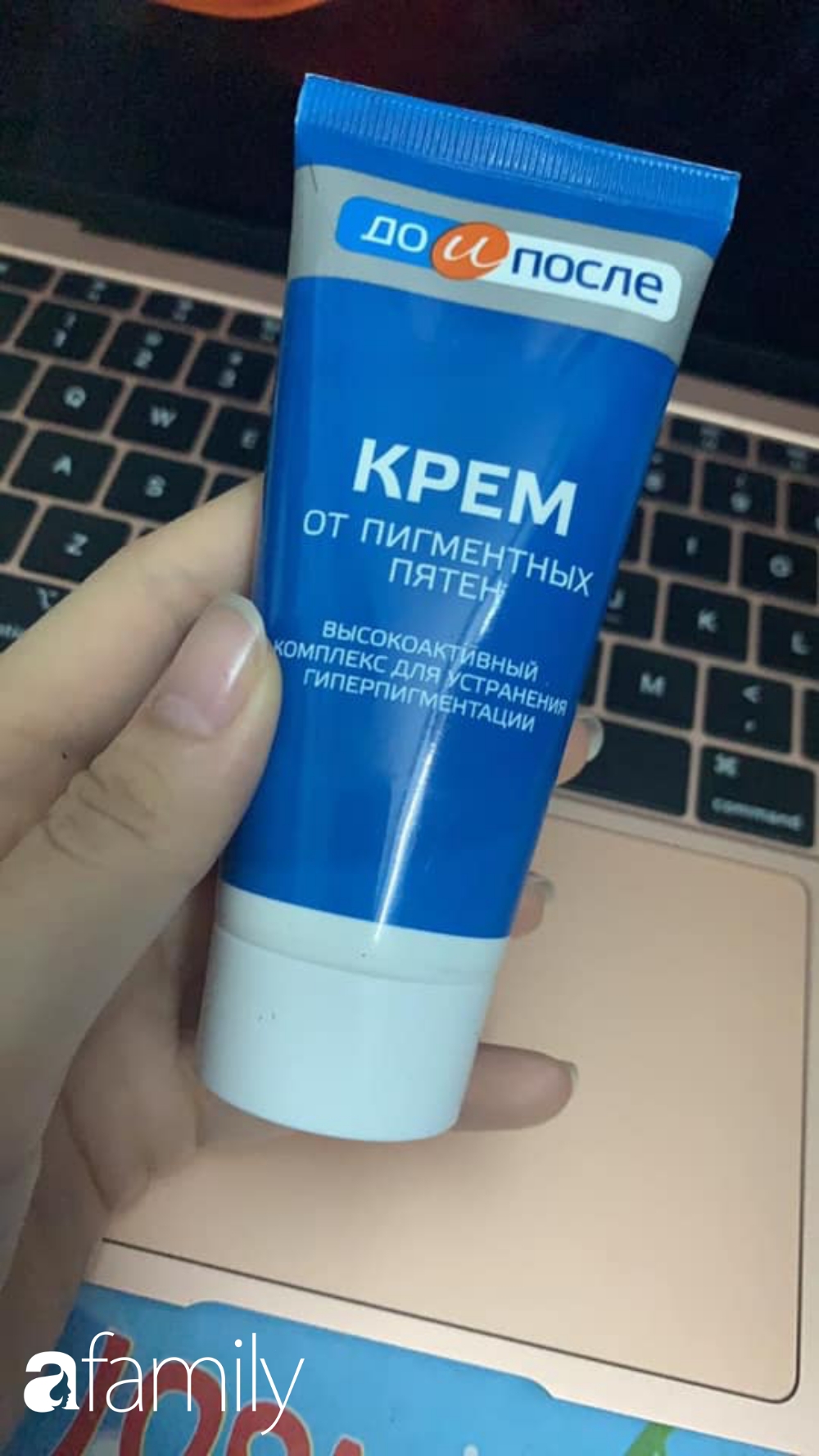 Tự chữa khỏi 95% đốm nâu ở tay, cô nàng này bày sẵn 4 kinh nghiệm và 2 tuýp kem bôi để các chị em học theo - Ảnh 5.