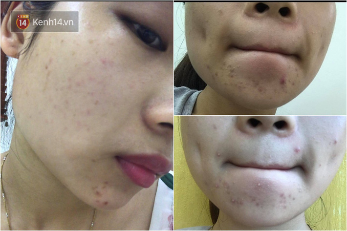 - Ảnh 1.