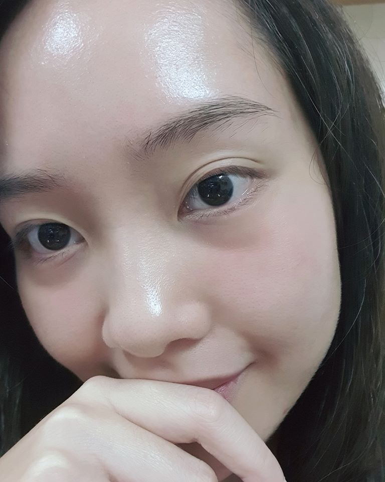 Trầy trật vì mụn suốt 2 năm, cô nàng này đã tìm được quy trình "6 sáng 7 tối" giúp da giảm thâm và căng sáng - Ảnh 2.