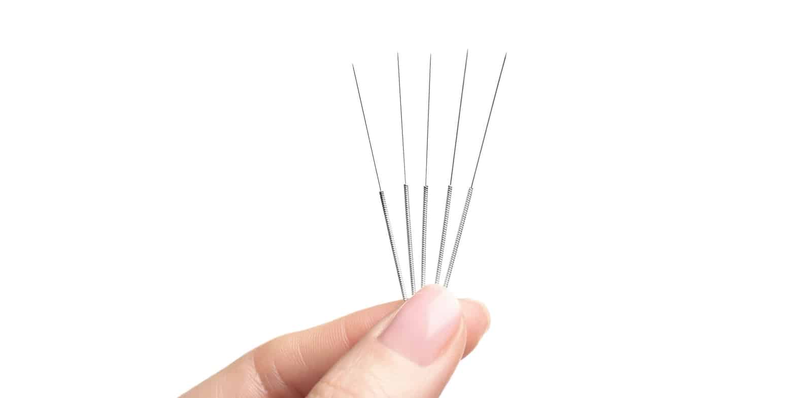 Traditional Chinese Medicine (TCM) Acupuncture