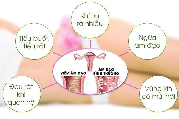 Biểu hiện của bệnh phụ khoa