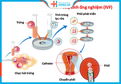 quá trình thụ tinh ống nghiệm