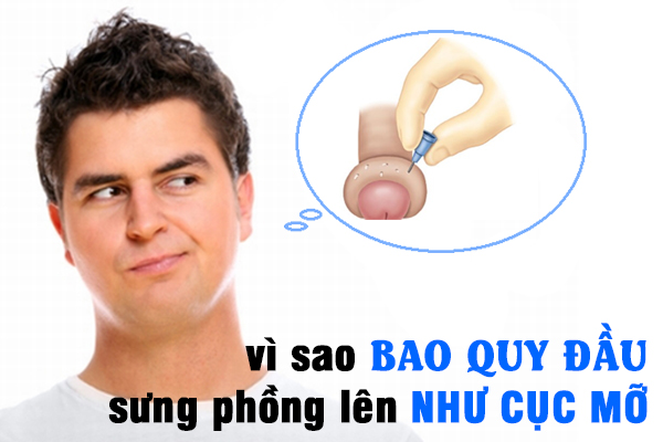 Bao quy đầu bị sưng và ngứa