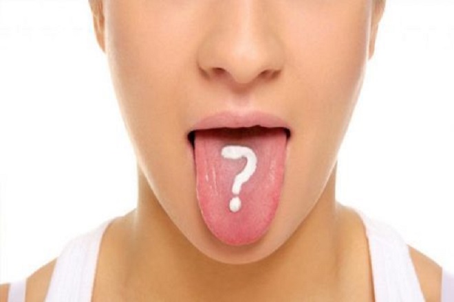 Bệnh giang mai ở lưỡi miệng: triệu chứng, hậu quả và cách phòng tránh như thế nào?
