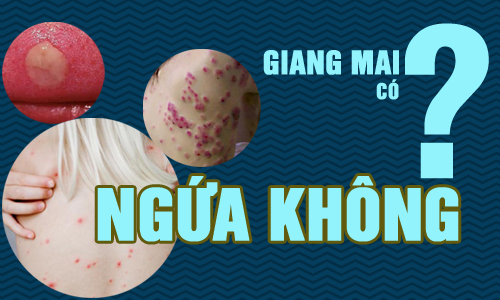 Giang mai có ngứa không?