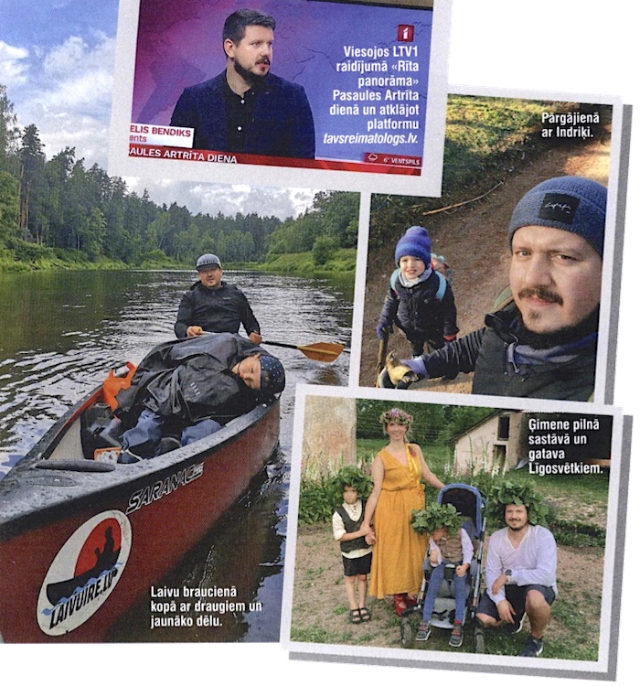 artrīts