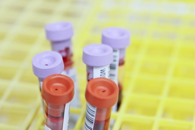 Plasma Rico em Plaquetas foi capaz de restaurar a função ovariana de mulheres como menopausa precoce. Fonte: Unplash