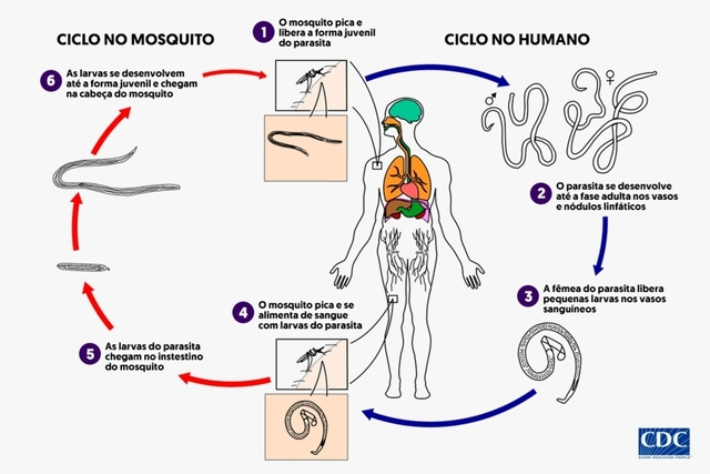 Ciclo de vida do Wuchereria bancrofti. Fonte: https://www.tuasaude.com/wuchereria-bancrofti/