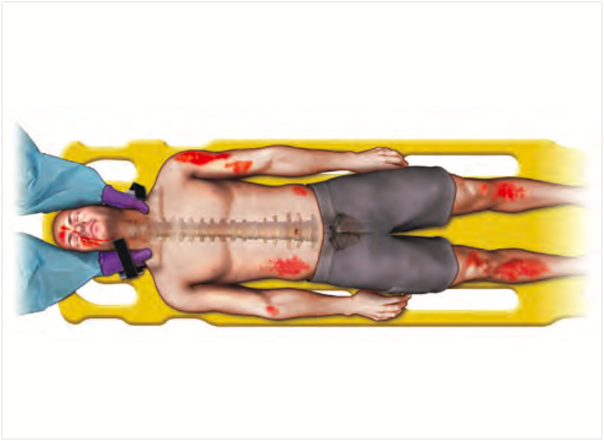 A: Airway – Vias aéreas e restrição da coluna cervical