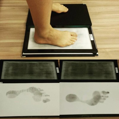 Fonte: Rodrigo Andrade Fisioterapia (https://randradefisio.com.br/avaliacao-computadorizada-fotogrametria/palmilhas-ortopedicas-e-posturais/plantigrafo/)