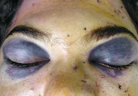 Rosto de homem visto de pertoDescrição gerada automaticamente