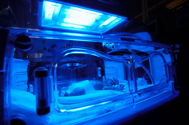 Quais são os tipos de prematuridade?