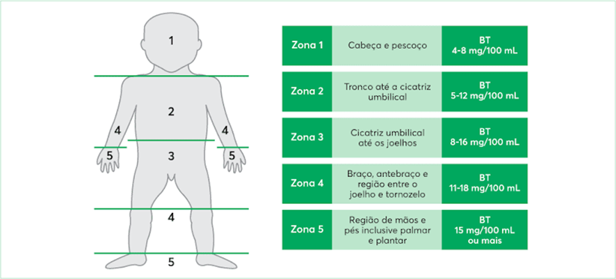 As Zonas de Krammer permitem mensurar a concentração de bilirrubina sérica . Fonte: Sociedade Brasileria de Pediatria, 2022