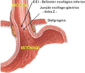 Representação da junção esôfago-gástrica (linha Z). Fonte: Instituto de Gatroenterologia Pediátrica de São Paulo