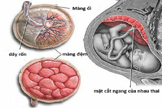 Bóc tách túi thai nhưng không ra máu