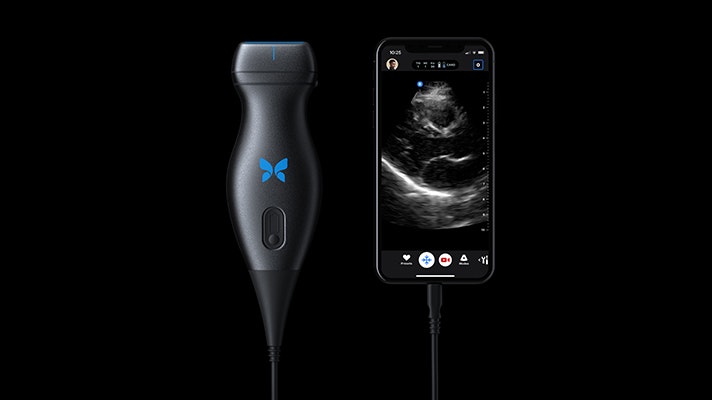 Butterfly rescinds features from handheld ultrasound device, working with FDA to re-enable | MobiHealthNews